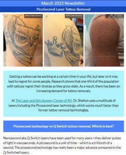 laser tattoo removal in nyc