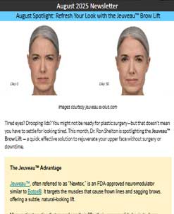 Refresh Your Look with the Jeuveau™ Brow Lift