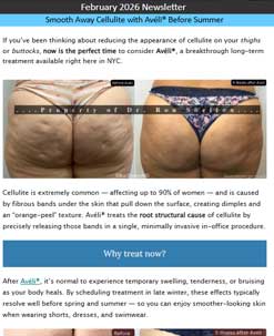 Smooth Away Cellulite with Avéli®