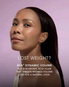 lost weight facial volume