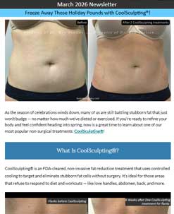 Freeze Away Those Holiday Pounds with CoolSculpting®!